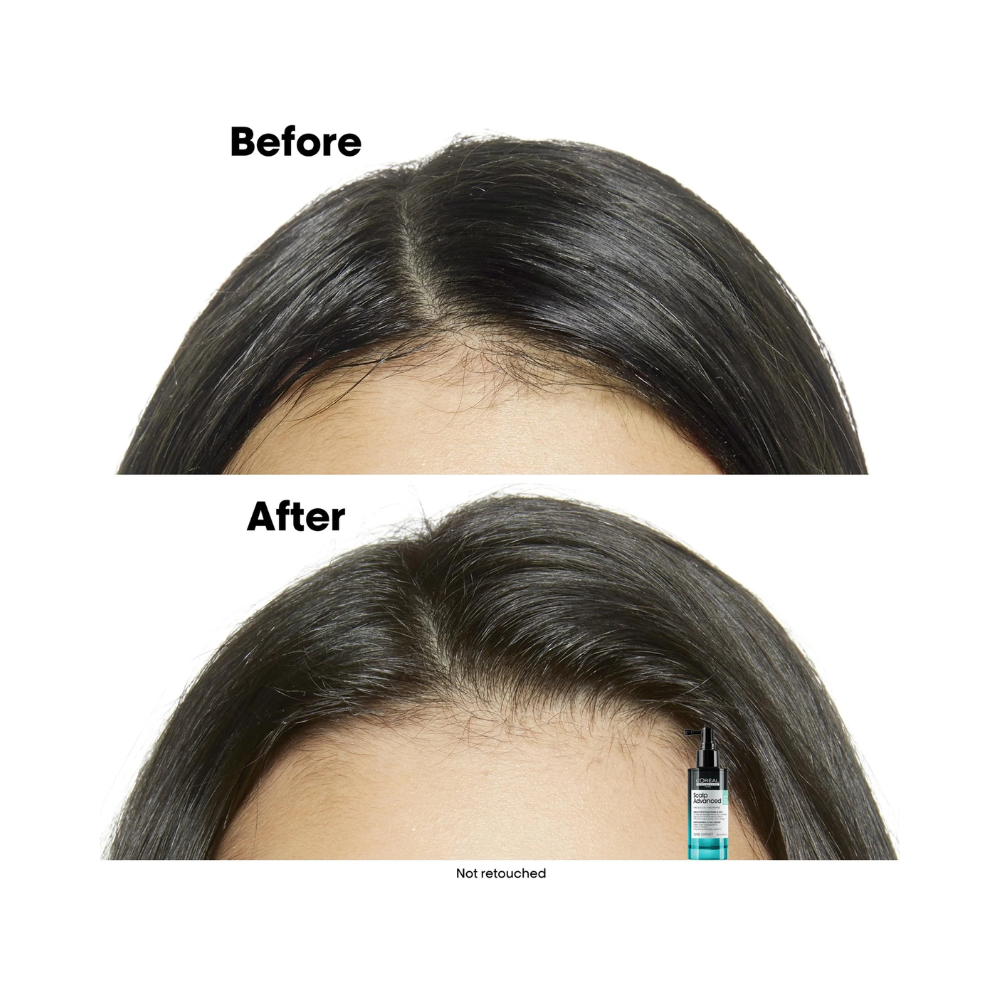 L’Oréal Serie Expert Scalp Advanced Professional 5-in-1 Serum, 90 ml